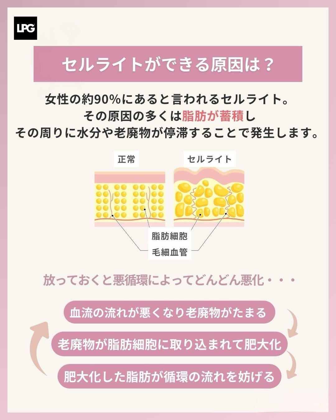endermologieアライアンス