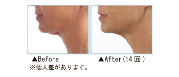 ビフォーアフター